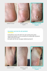 Ariul Smooth & Pure Exfoliating Foot Peeling Mask - Çorap Tipi Yenileyici & Arındırıcı Ayak Peeling Maskesi