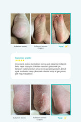 Ariul Smooth & Pure Softening Foot Peeling Mask Sheet - Çorap Tipi Deri Yumuşatan Ayak Peeling Maskesi